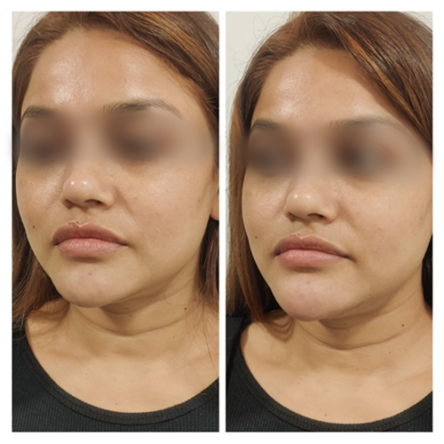 blog-post-image